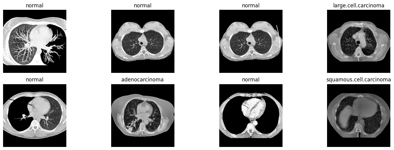 Example of CT scan slices showing different lung conditions